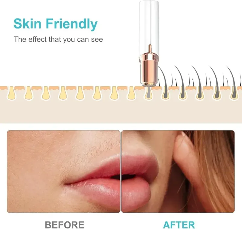 Facial hair remover